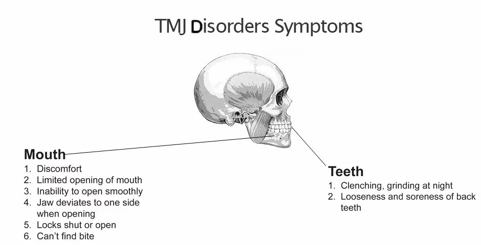 TMJ Disorders sypmtoms